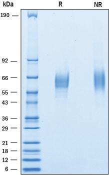 R&D Systems Recombinant Mouse CD200 R1 His-tag Protein CF (