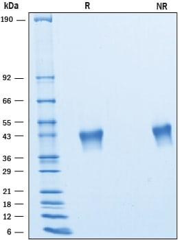 R&D Systems Recombinant Human VSTM2B His-tag Protein CF (50