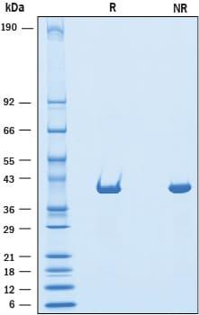 R&D Systems Recombinant Human Dihydroorotate Dehydrogenase