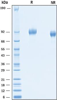 R&D Systems Recombinant Mouse PDGF R alpha His-tag Protein
