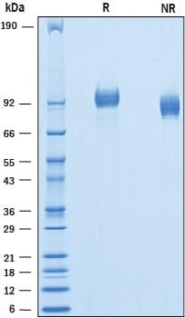 R&D Systems Recombinant Mouse PDGF R beta His-tag Protein C