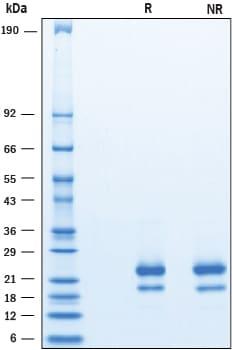 R&D Systems Recombinant Human IFN-gamma (HEK293-expressed) P