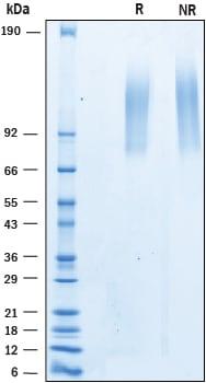 R&D Systems Recombinant Human ELFN1 His-tag Protein CF (50