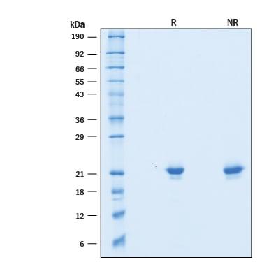 R&D Systems Recombinant Mouse IFNAB Protein CF (50 UG)