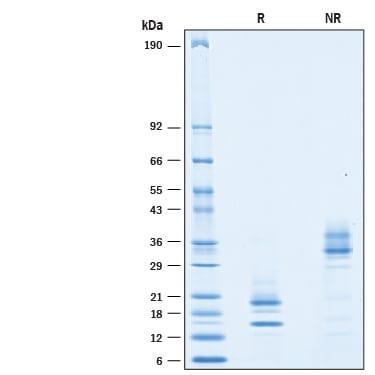 R&D Systems Recombinant Cynomolgus Monkey IL-17/IL-17A Prote