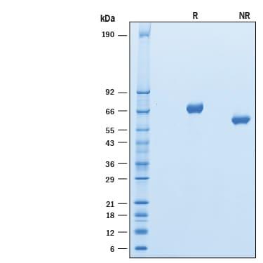 R&D Systems Recombinant Human Kirrel1/NEPH1 His-tag Protein