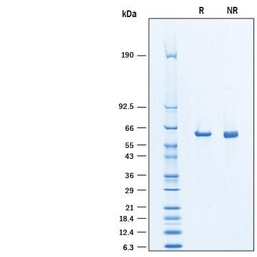 R&D Systems Recombinant Human Asparagine Synthetase/ASNS His