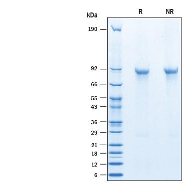 R&D Systems Recombinant Mouse ANGPTL8/Betatrophin His-tag Pr