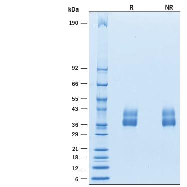 R&D Systems rmVSTM4 His CF (50 UG)