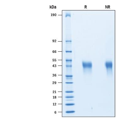 R&D Systems rhTIM-3 His CF (50 UG)