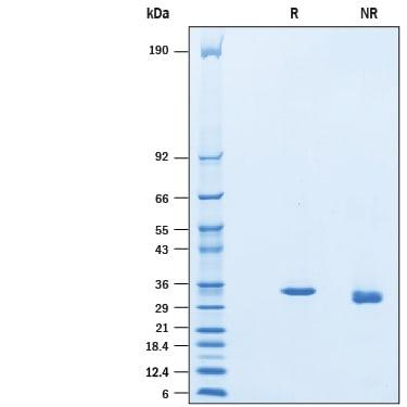 R&D Systems rhSirtuin 5/SIRT5 Hi (50 UG)