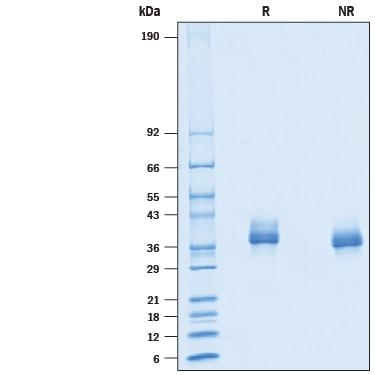 R&D Systems rmSiglec-15 His CF (50 UG)
