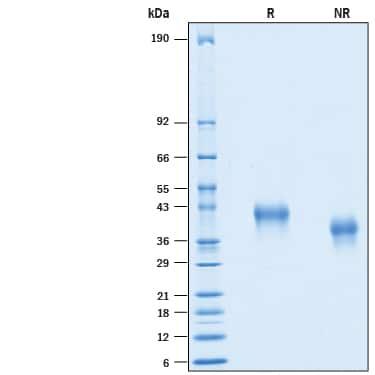 R&D Systems Recombinant Human CD25/IL-2R alpha His-tag Prote