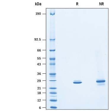 R&D Systems rhHPRT His CF (50 UG)