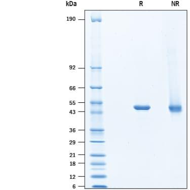 R&D Systems rhODC1 His CF (20 UG)