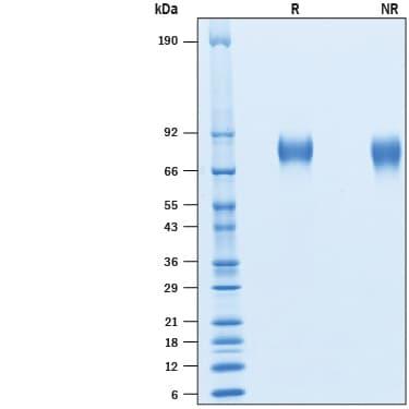 R&D Systems rcynoCD6 His CF (50 UG)