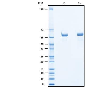 R&D Systems Recombinant Human Chromogranin A His-tag Protein
