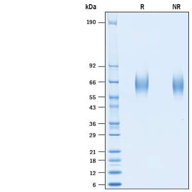 R&D Systems rcynoGM-CSF Ra His (50 UG)