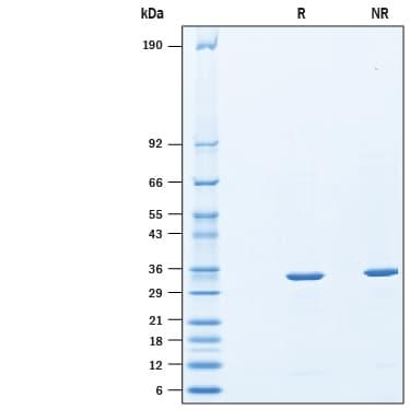 R&D Systems reBirA His CF (100 UG)