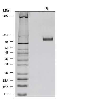 R&D Systems Recombinant Mouse Netrin-1 P