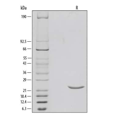 R&D Systems Recombinant Human Sonic Hedg