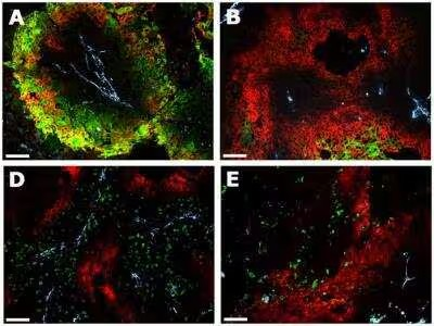 Novus Carbonic Anhydrase IX/CA9 Antibody