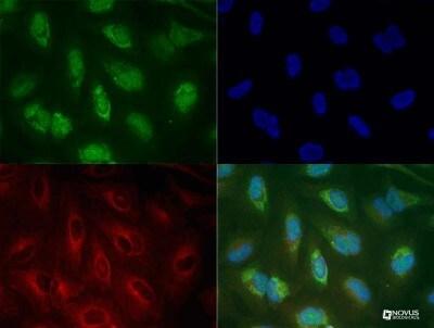 Novus PINK1 Antibody, 0.1 ml