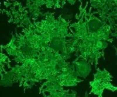 Novus CD40/TNFRSF5 Antibody (G28-5), 0.1