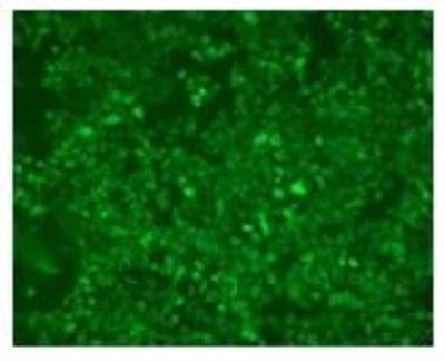 Novus CD40 Ligand/TNFSF5 Antibody (LL2),