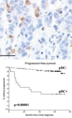 Novus IL-3 R alpha/CD123 Antibody (107D2