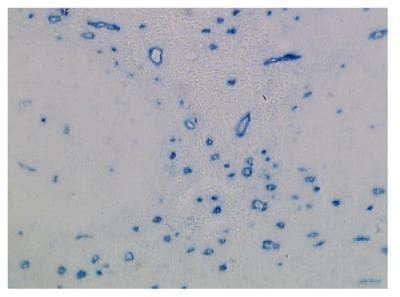 Novus Langerin associated lectin Antibod