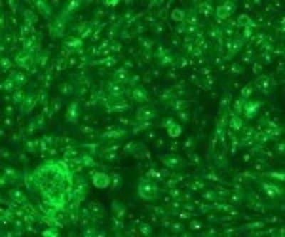 Novus Langerin/CD207 Antibody (808E10.01