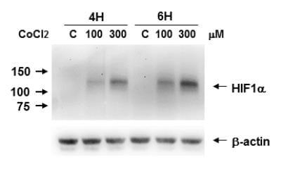 Novus HIF-1 alpha Antibody (H1alpha67),