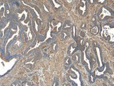Novus VPS35 Antibody, 0.1 mg