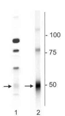 Novus GABA-A R delta Antibody, 0.1 ml