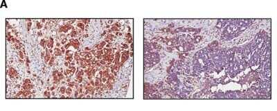Novus ABCA1 Antibody, 0.1 ml