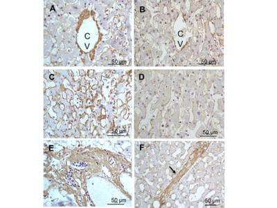 Novus Collagen III alpha 1/COL3A1 Antibo
