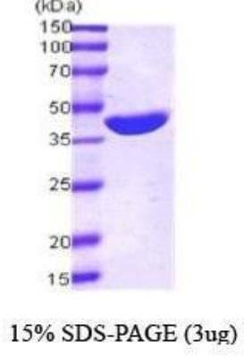 Novus Maltose Binding Protein Protein, 0