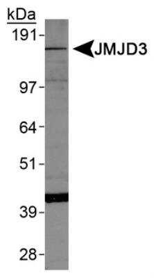 Novus Lysine (K)-specific Demethylase 6B