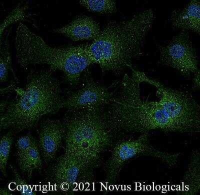 Novus LDL R Antibody, 0.1 ml