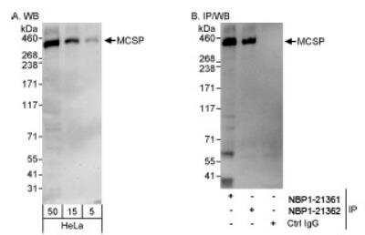 Novus NG2/MCSP Antibody, 0.1 ml