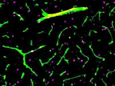 Novus Olig2 Antibody, 0.1 ml