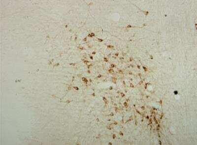 Novus Choline Acetyltransferase/ChAT Ant