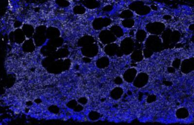 Novus TGF-beta 1 Antibody, 100ul
