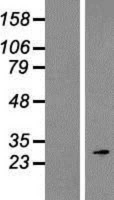 Novus ROPN1 Overexpression Lysate (Nativ