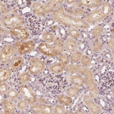 Novus SLC34A1 Antibody, 0.1 ml