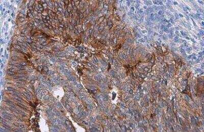 Novus Coagulation Factor III/Tissue Fact