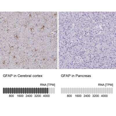 Novus GFAP Antibody, 0.1 ml