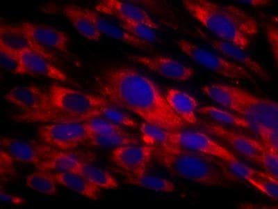 Novus Fibroblasts Antibody (TE-7),  50 u