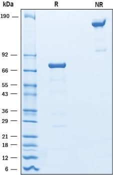 R&D Systems Recombinant Mouse OLT-2/TARM1 Fc Chimera Protei